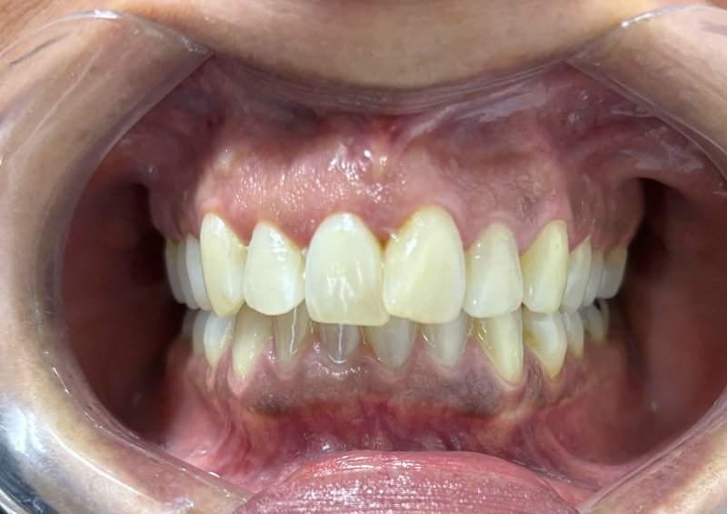 Urgencias dentales